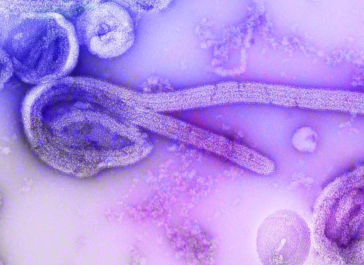 What Is The Marburg Virus And How Is It Spread Review Guruu